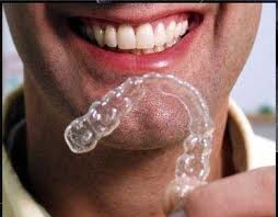 invisalign audy dental