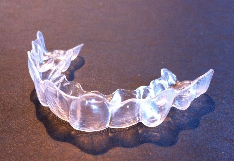 invisalign behel gigi audy dental