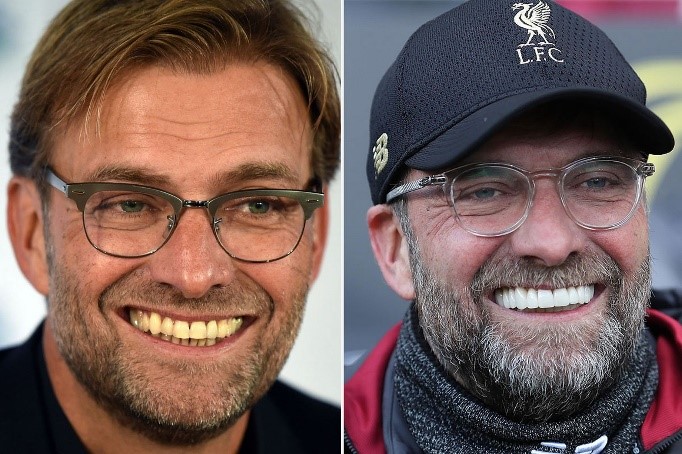 Jurgen Klopp Gigi Putih Audy Dental